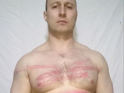 Пытки в полиции. Фото: flashnord.com